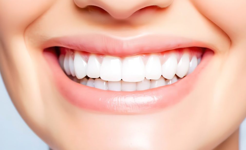 ESTETICA - FATETE - COROANE - LUCRARI PE IMPLANTURI